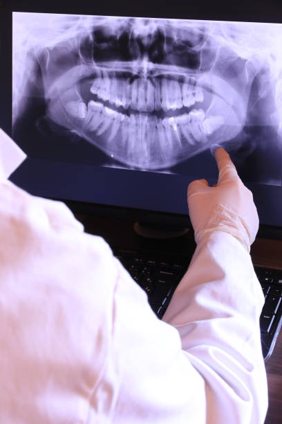 Best Emergency Root Canal Therapy in Liberty Hill, TX