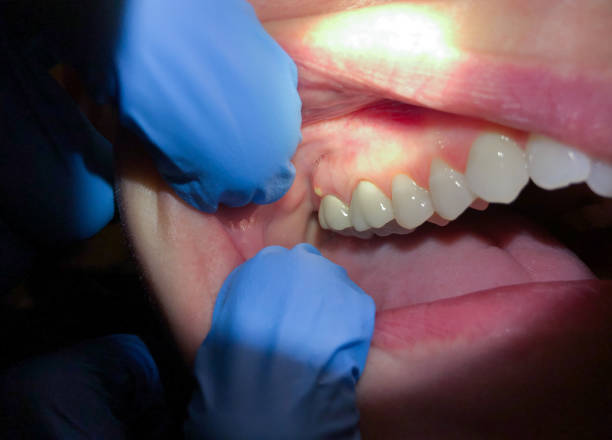 Best 24-Hour Emergency Dental Care in Liberty Hill, TX
