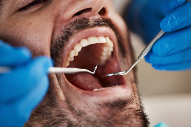 Best Emergency Care for Gum Disease in Liberty Hill, TX