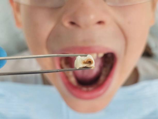 Best 24-Hour Emergency Dental Care in Liberty Hill, TX